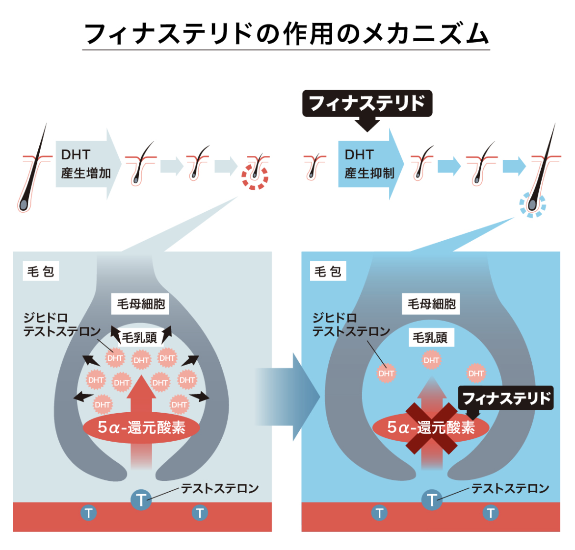 フィナステリドの作用機序を示す図
