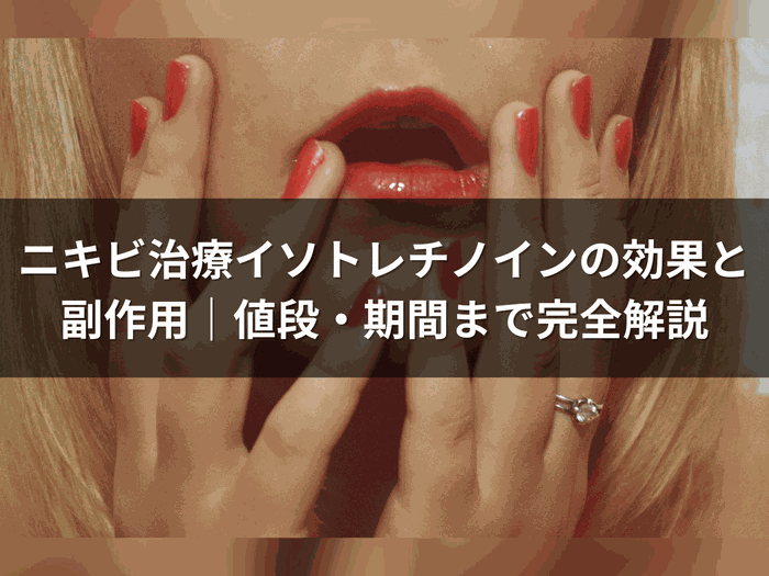ニキビ治療イソトレチノインの効果と副作用・値段・期間を解説する記事のバナー画像
